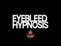Eyebleed Hypnosis walkthrough video Spiel