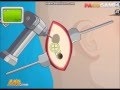 Operate Now: Ear surgery walkthrough video game