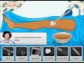 Operate Now: foot surgery walkthrough video jeu